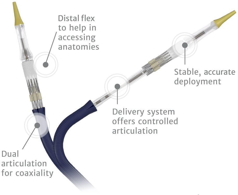 SAPIEN valve design — transformative technology | HeartValves