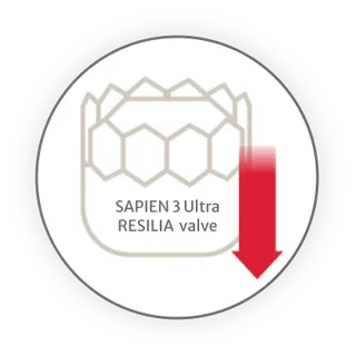 SAPIEN 3 Ultra RESILIA valve icon