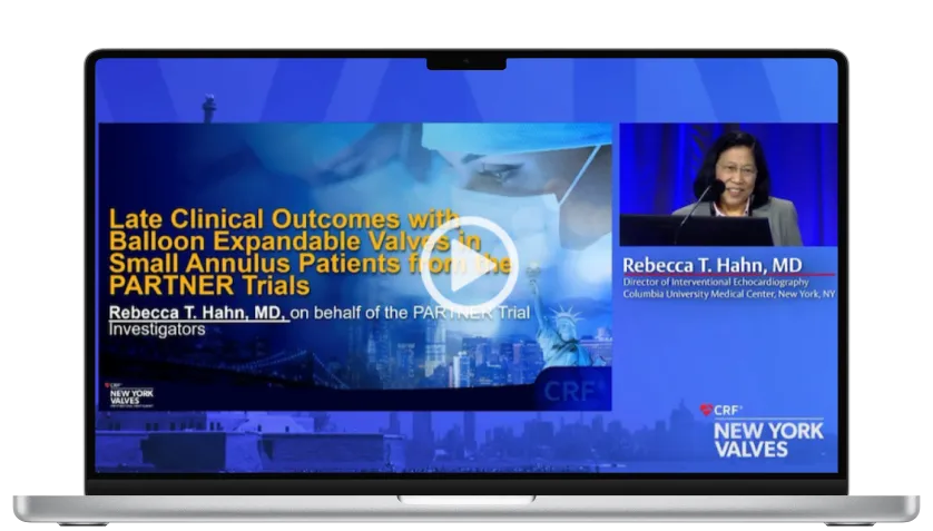 Image of video thumbnail about a presentation by Dr. Rebecca T. Hahn